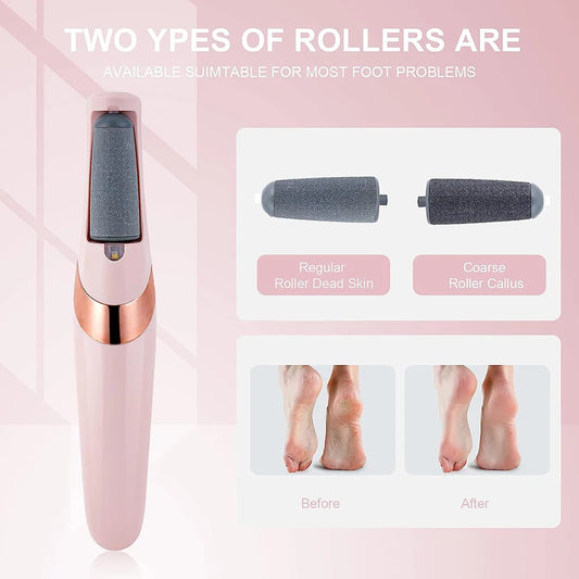 Electric Pedicure Tool -  Foot Dead Skin Remover